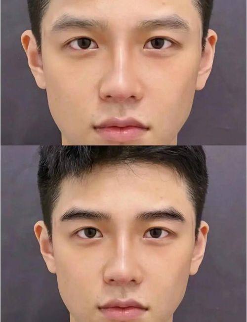 广州雍禾植发预约挂号方式：