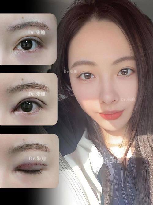 韩悦医生怎么预约