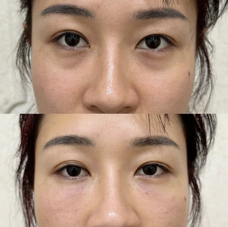 二、疤痕修复中 心的有效性,关键看什么?