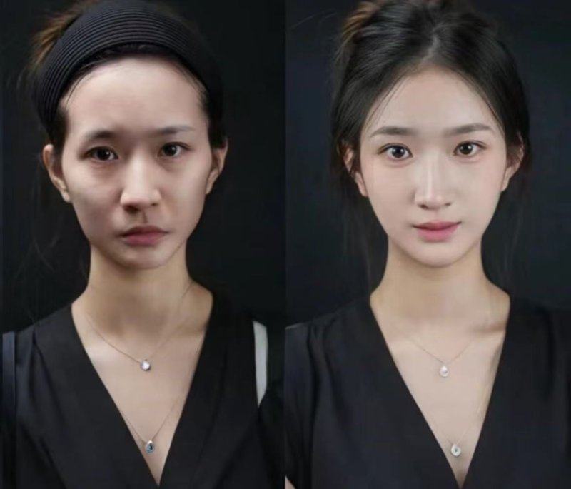 宜宾爱迪眼耳鼻喉医院价格表