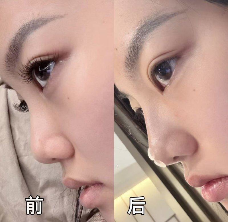 宁波鄞州乐缇整形医院价格表: