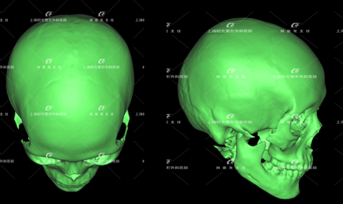 五、医美祛眼袋的安心性与性价比提示