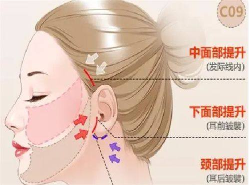 茶包去眼袋的作用原理：仅针对临时浮肿起效