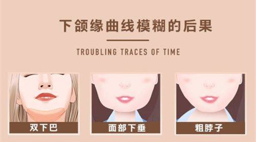 5g光雕吸脂多少钱？避坑指南帮你不花冤枉钱