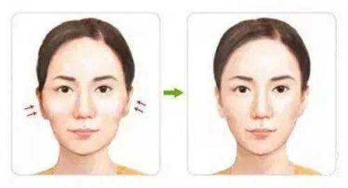 四、饮食调理:这些食物会延缓疤痕修复