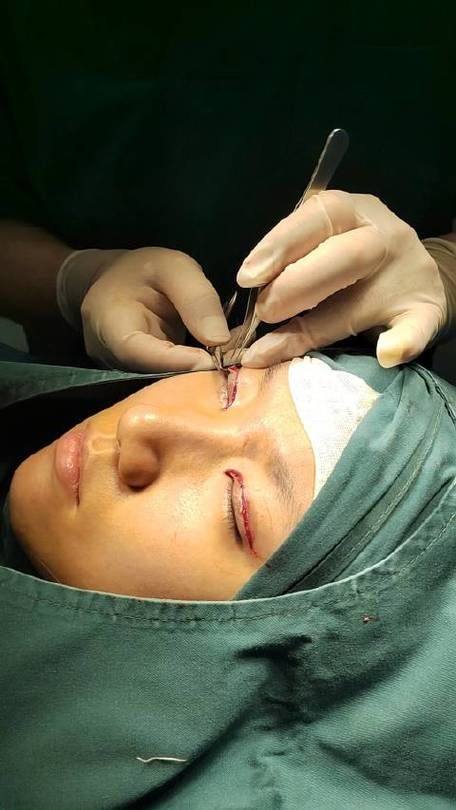 深圳卓颜医疗美容诊所擅长项目：