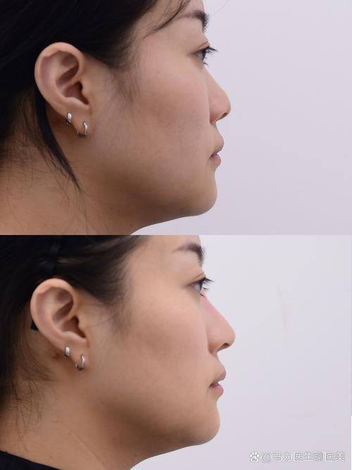 新疆千禧丽人整形美容专科医院价格表: