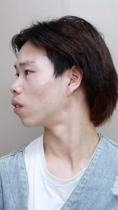 陈明辉医生擅长领域