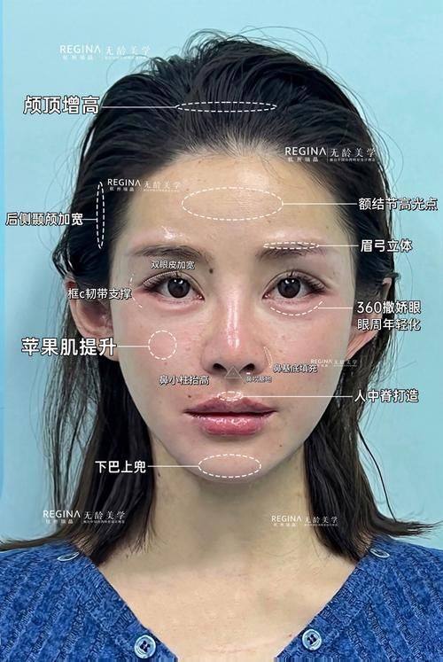 香港SWISSOBeautyExpert整形擅长项目: