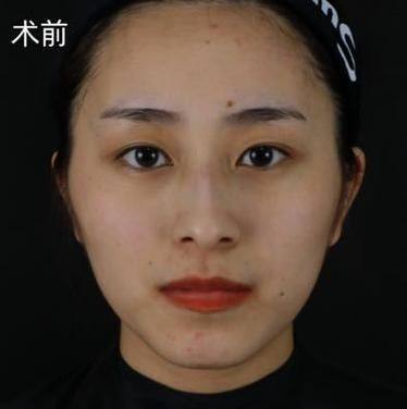 夏炜医生怎么预约