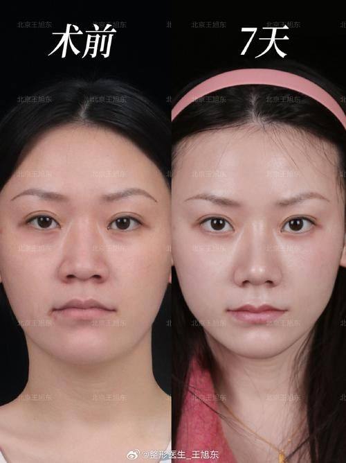 郑州美时美刻医疗美容门诊部预约挂号方式