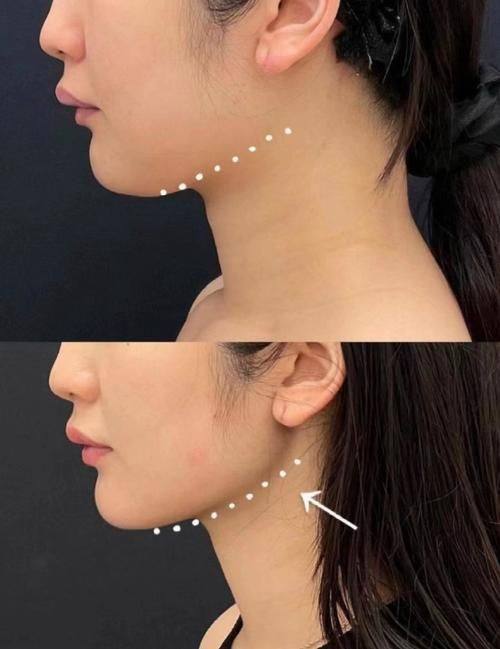 夏炜医生口碑评价