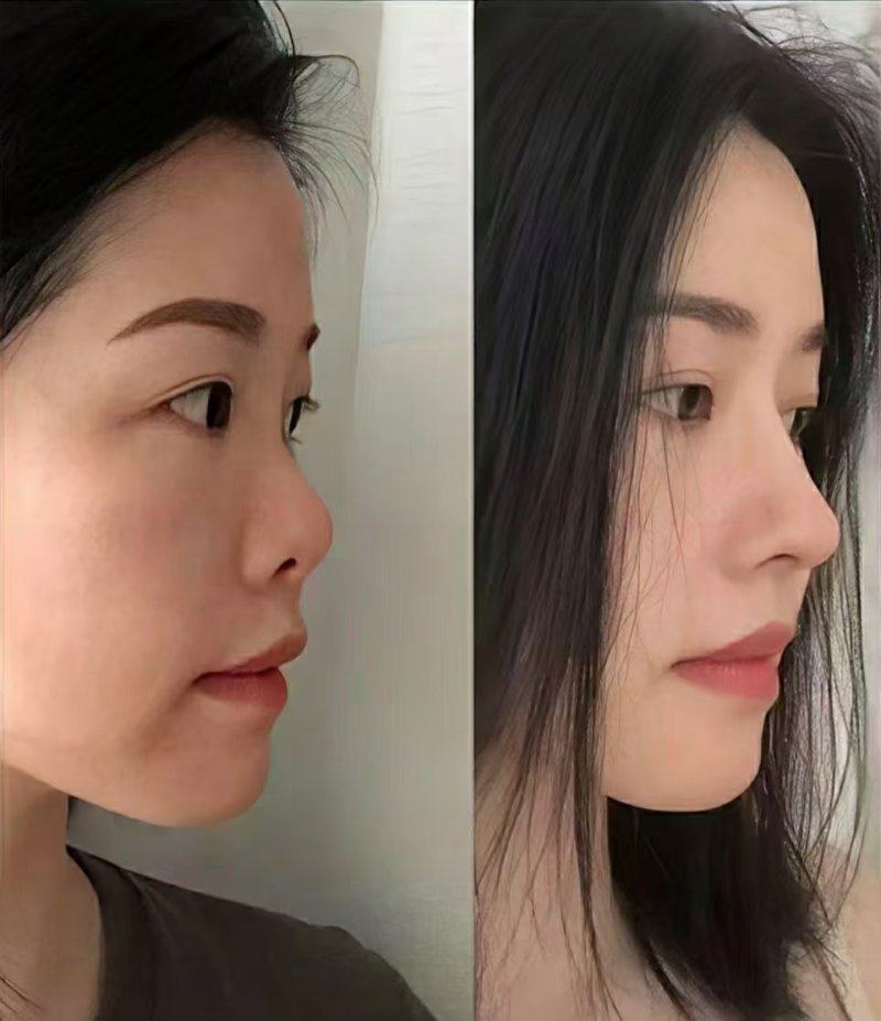 五、饮食助力:吃这些加快疤痕变淡消失