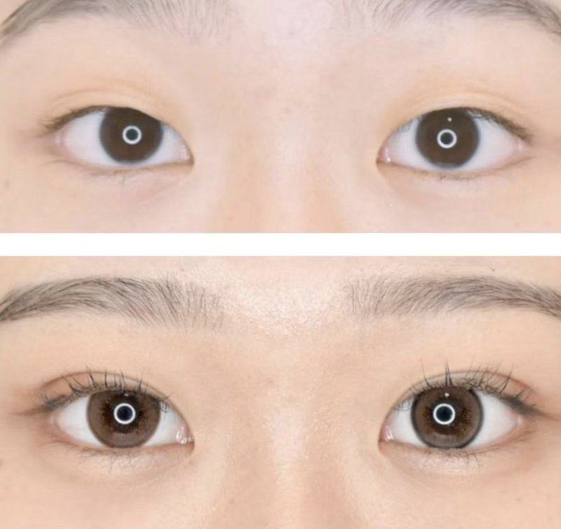 沈阳童颜医疗美容和平院区擅长项目: