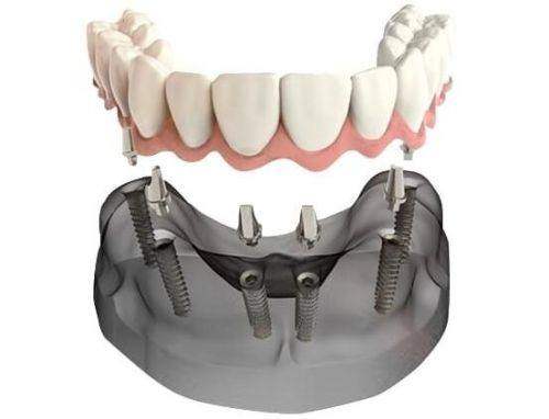 郑州美美整形美容医院擅长项目