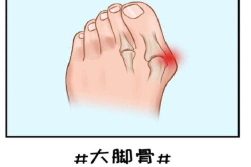 五、隆胸后可以做瑜伽和剧烈运动吗?这些红线不能碰