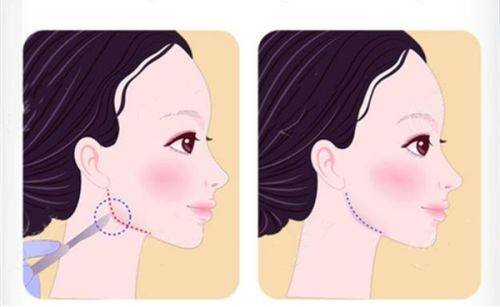 郑州美美整形美容医院价格表