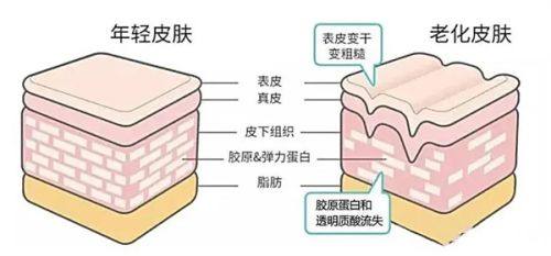 二、轻度/暂时性眼袋：日常护理是基础改善方案