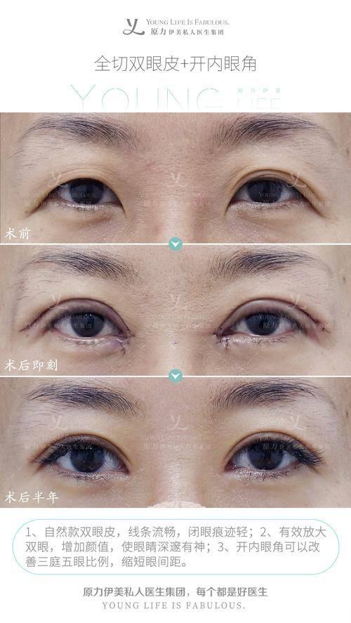 西安亚美医疗美容诊所地址电话及营业时间：