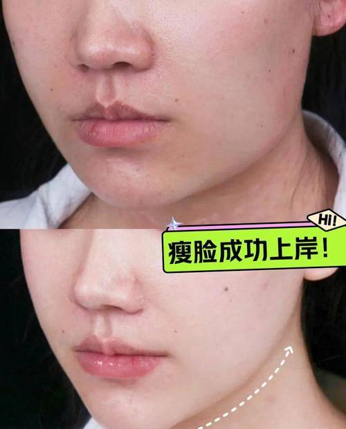 西安亚美医疗美容诊所口碑评价：