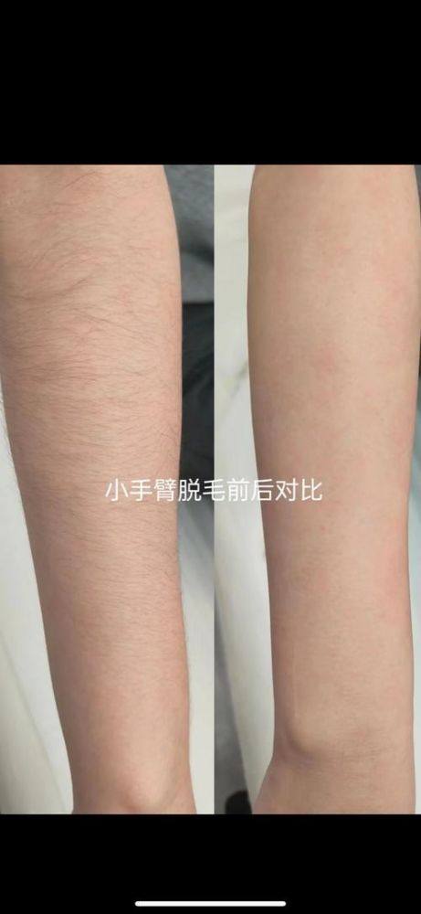 徐州矿务总医院整形美容中 心预约挂号方式：