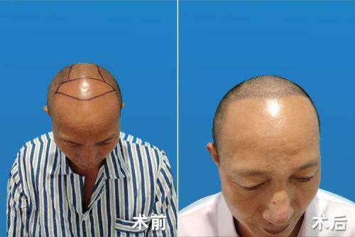 于艳医生怎么预约