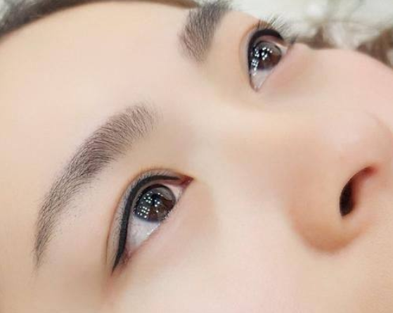 五、如何让双眼皮术后的眼睛放大成效更理想