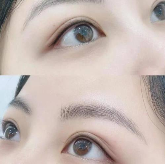 五、手术疤痕增生护理的配套注意事项