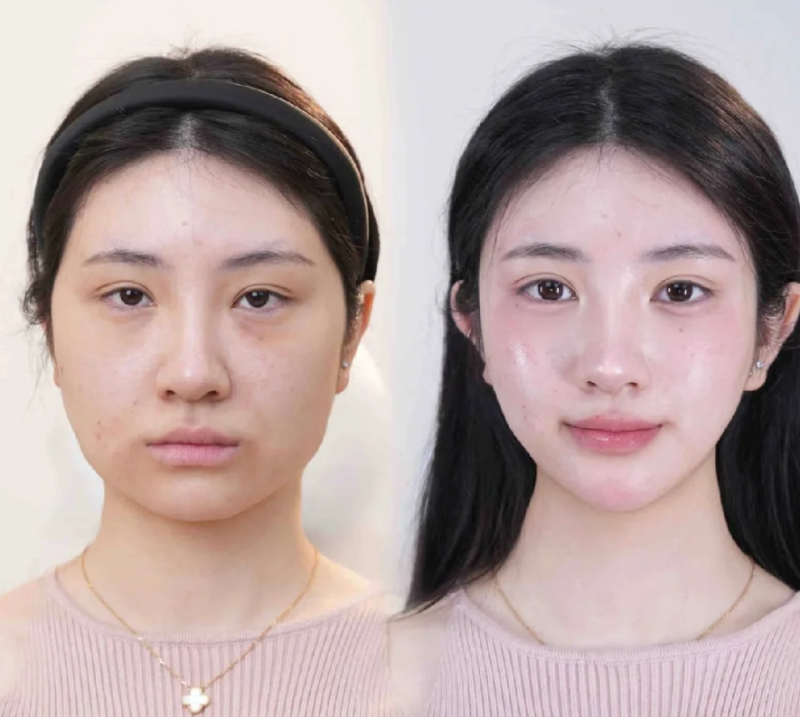 五、眼袋厉害用什么眼霜,日常预防不能少