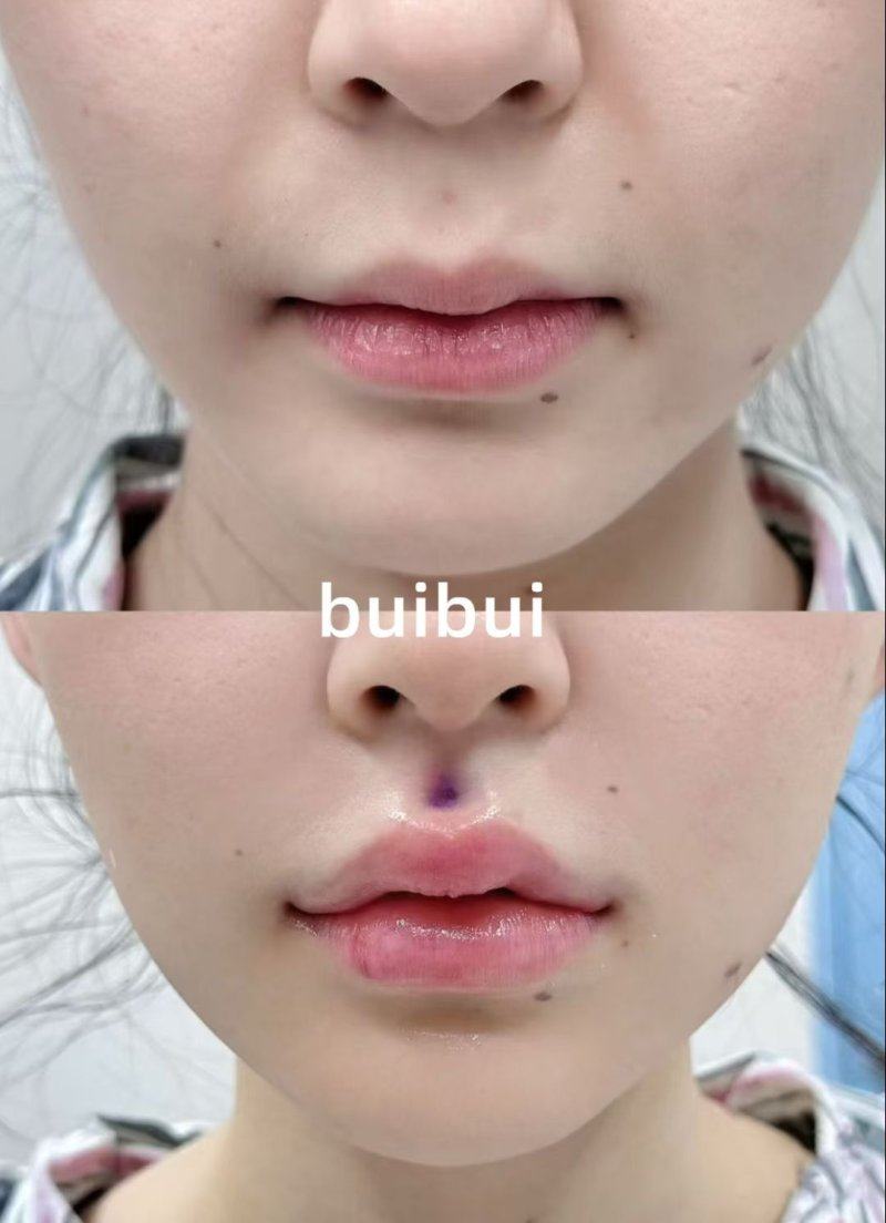 三、中期护理：成效形成关键期的避坑指南