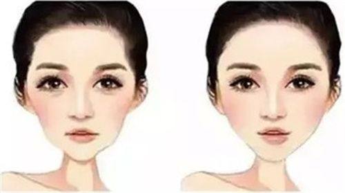 四、术前术后避坑指南,远离祛眼袋后“反成效”