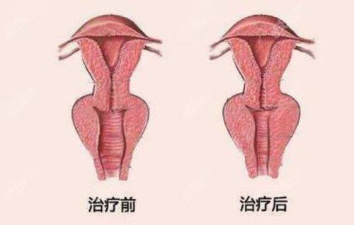 四、中药治疗疤痕疙瘩的优势:安心、便捷、兼顾长远