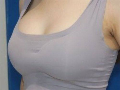 二、子宫疤痕怎么修复更好