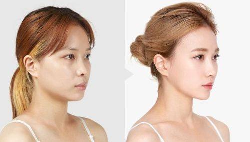 杭州梵须伽颜医疗美容诊所擅长项目：