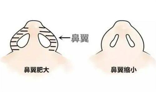 五、芭克使用期间，疤痕出现这些情况要及时就医