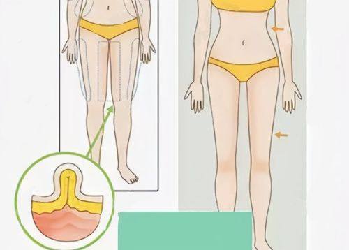 四、医生专属精细化护理方案，精细加速消肿
