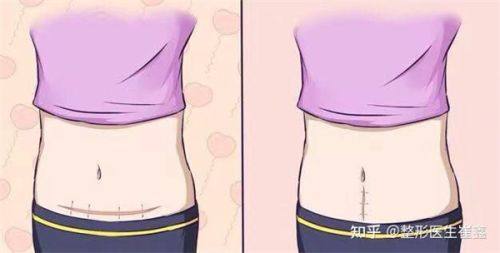 四、刮痧去眼袋的成效对比与合理预期