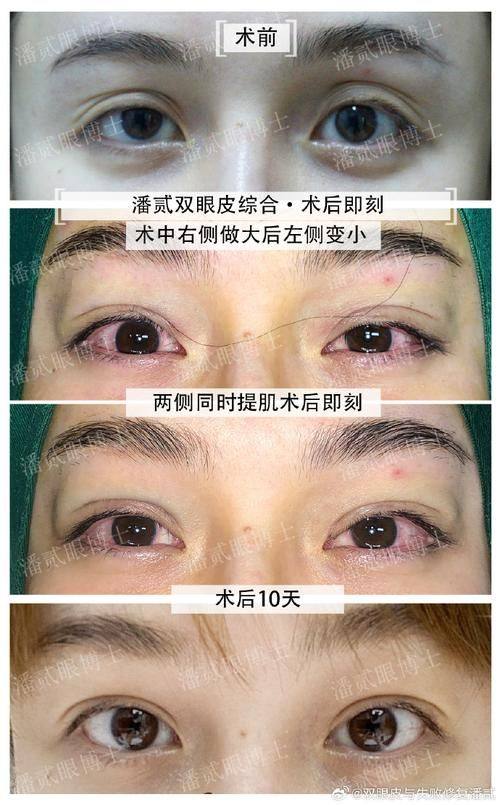 兰州美丽达整形医院擅长项目：