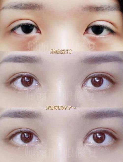 贵州省红十字会妇女儿童医院整形美容中 心医生名单及擅长领域