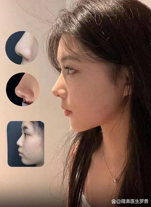 重庆真熙美整形医院地址电话及营业时间：