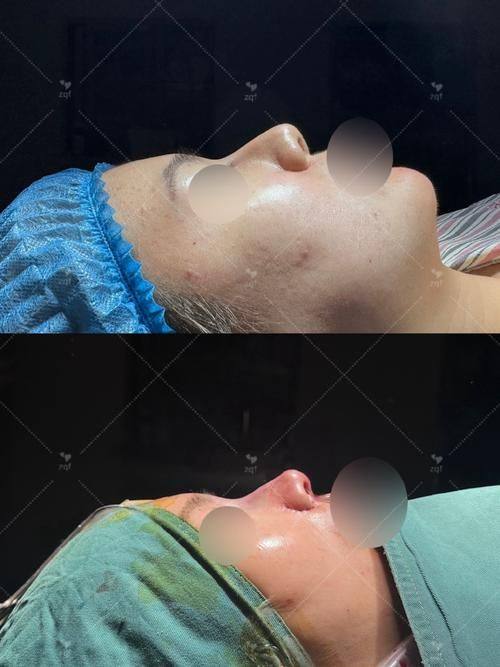 兰州美丽达整形医院价格表：