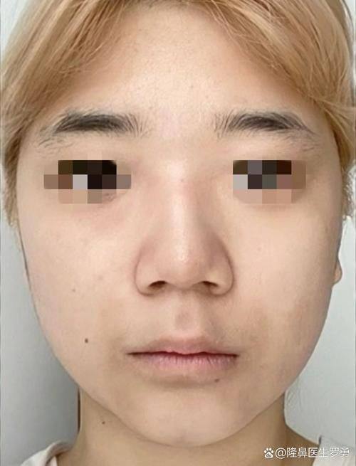 广州军区武汉总医院医学整形美容中 心怎么样？