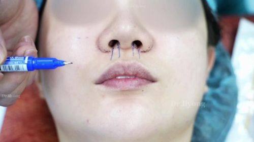 蔡博恩(Dr.Bonn)医生技术优势