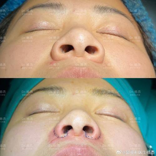 蔡博恩(Dr.Bonn)医生怎么预约?