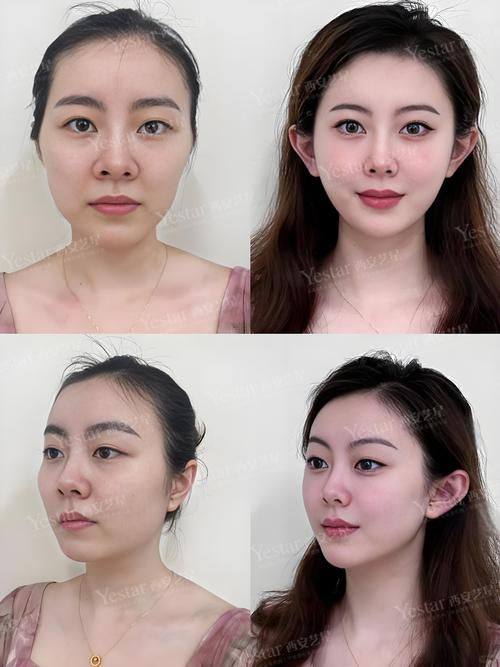 兰州美丽达整形医院地址电话及营业时间：