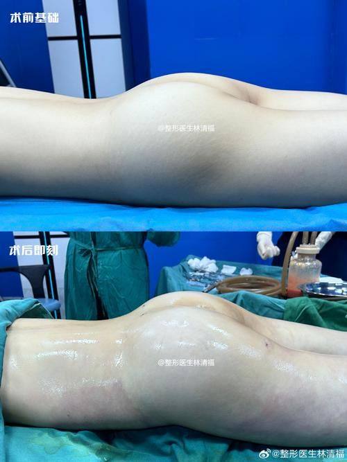 张汉良医生怎么预约？