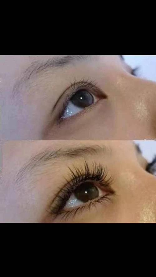 于艳医生技术优势: