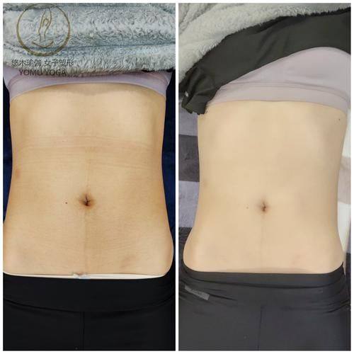 灵宝巨星医疗美容诊所怎么样?