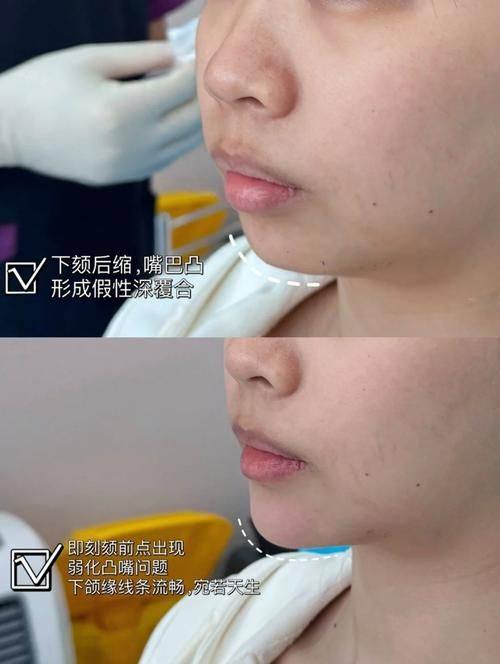 南通颜泰整形医院预约挂号方式