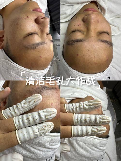 杭州开颜美学整形医院怎么样？